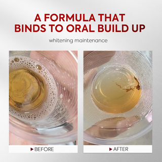 FreshMira – Stain-Lifting Whitening Mouthwash