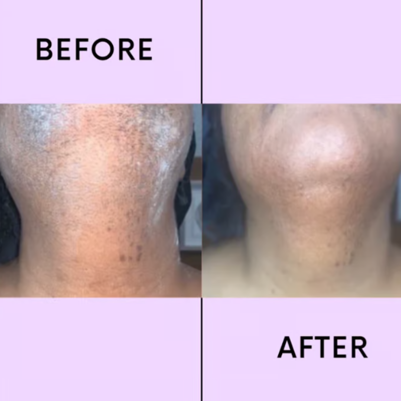 SmoothEase – Gentle Facial Hair Removal Device