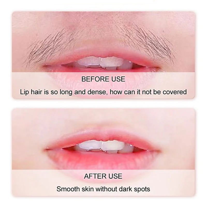 SoftSilk Pro - Painless Facial Hair Remover – Hydrating & Gentle