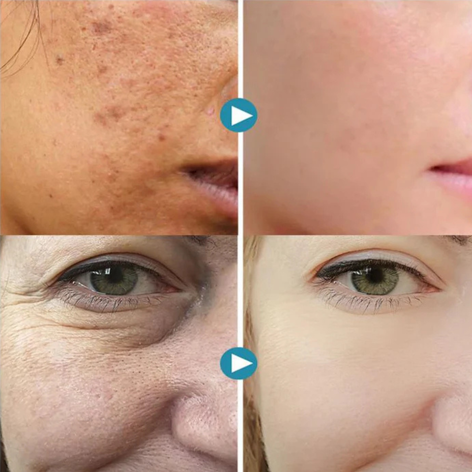 SkinAura – Korean Pore-Refining Cream