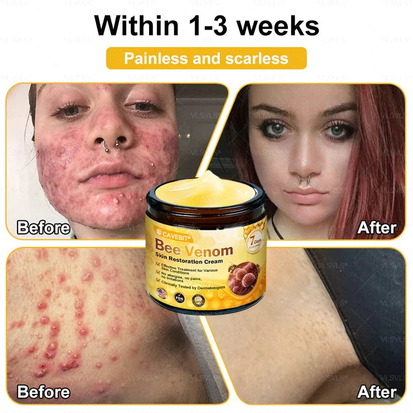BeeLuxe – Premium Bee Venom Firming Face Cream