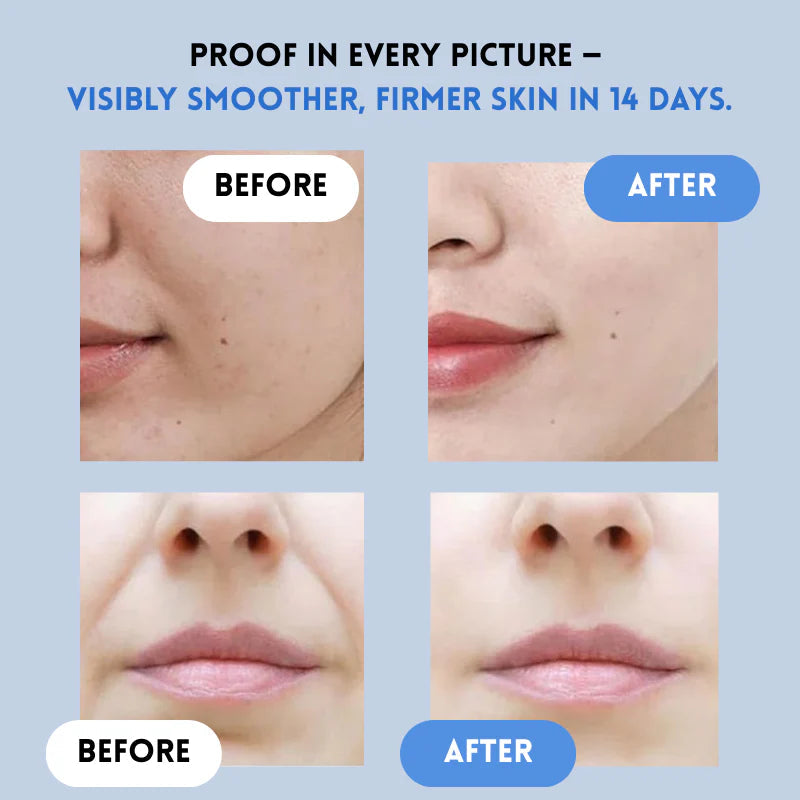 Auralift – Renew Strips for Ageless Radiance