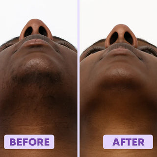 SilkAway – Silky Smooth Facial Hair Removal Cream