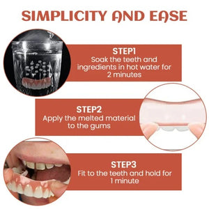 DentaEase – Simple Silicone Reline Kit