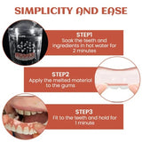 DentaEase – Simple Silicone Reline Kit
