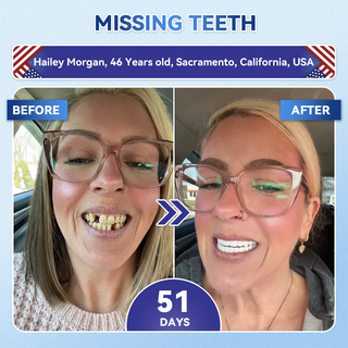 Dentafresh Pro – Whitening Repair Strips