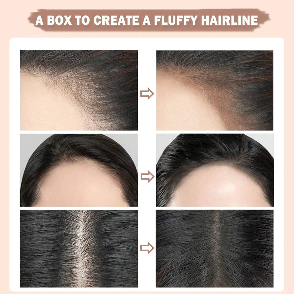 🔥Mother's Day Hot Sale 34% OFF-🔥 Hairline Contouring🌈BUY 3 & FREE SHIPPING marnetic