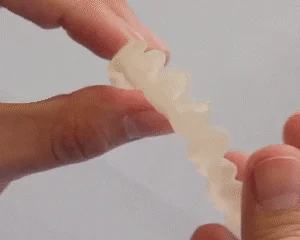 SmileEase – Hassle-Free Snap-On Dentures