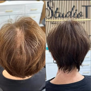 Invisible Volume Boost Hair Topper for Thinning Crowns