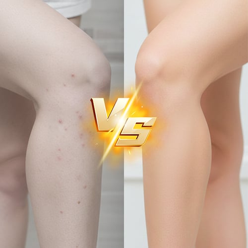 PureTrim - Hygienic Intimate Grooming Device