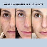 Auralift – Renew Strips for Ageless Radiance