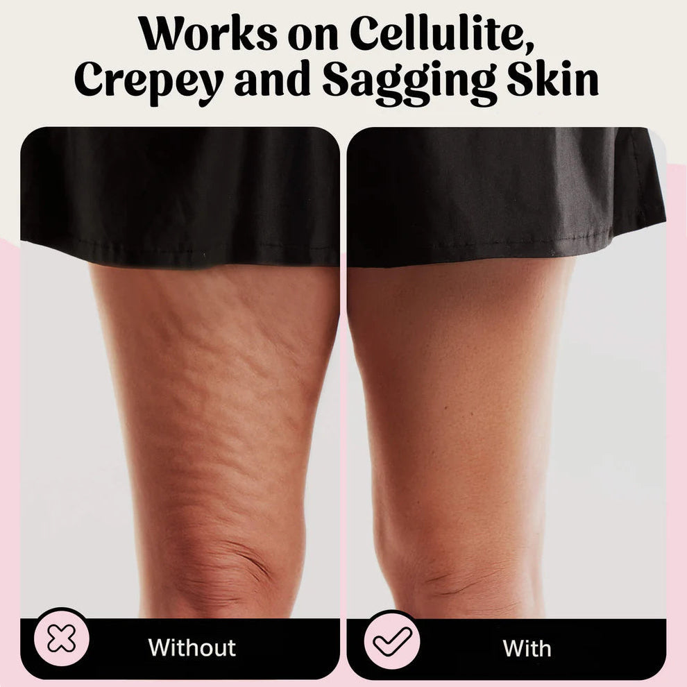 DermaBond – Skin Tape for Sensitive Skin