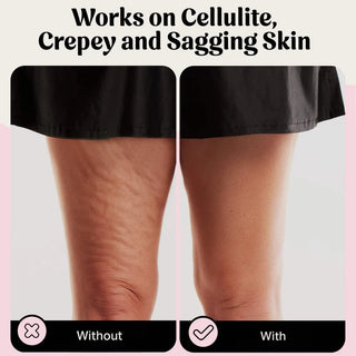 DermaBond – Skin Tape for Sensitive Skin