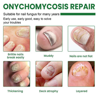 CrystalTips – Hydrating Serum for Stronger Nails