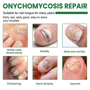 CrystalTips – Hydrating Serum for Stronger Nails