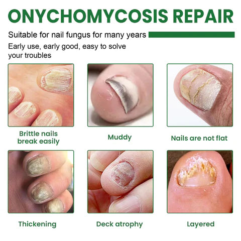 CrystalTips – Hydrating Serum for Stronger Nails