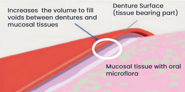 SureBond Adhesive - Durable Retention, Lasting Comfort