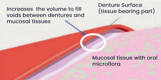 SureBond Adhesive - Durable Retention, Lasting Comfort