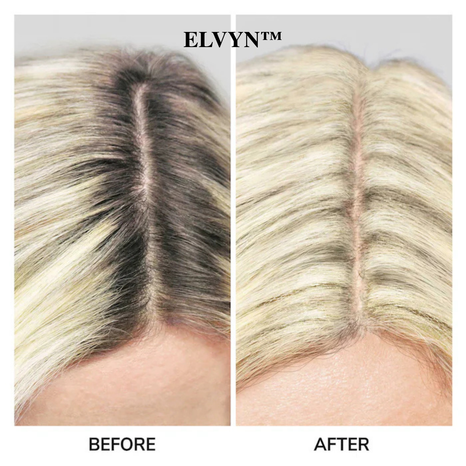 ELVYN – Precision Hair Touch-Up Brush
