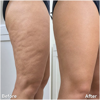 FirmAura – Intensive Body Smoothing & Firming Oil