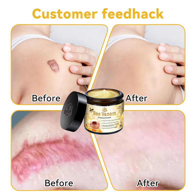SkinShine - Advanced Bee Venom Skin Smoothing Cream