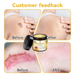 SkinShine - Advanced Bee Venom Skin Smoothing Cream