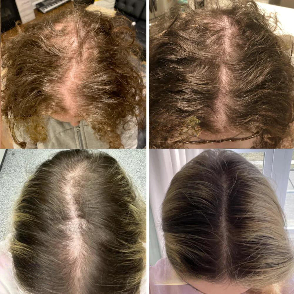 Nature’s Tress – Hair Revitalizing Oil