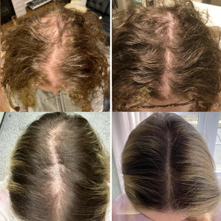 Nature’s Tress – Hair Revitalizing Oil