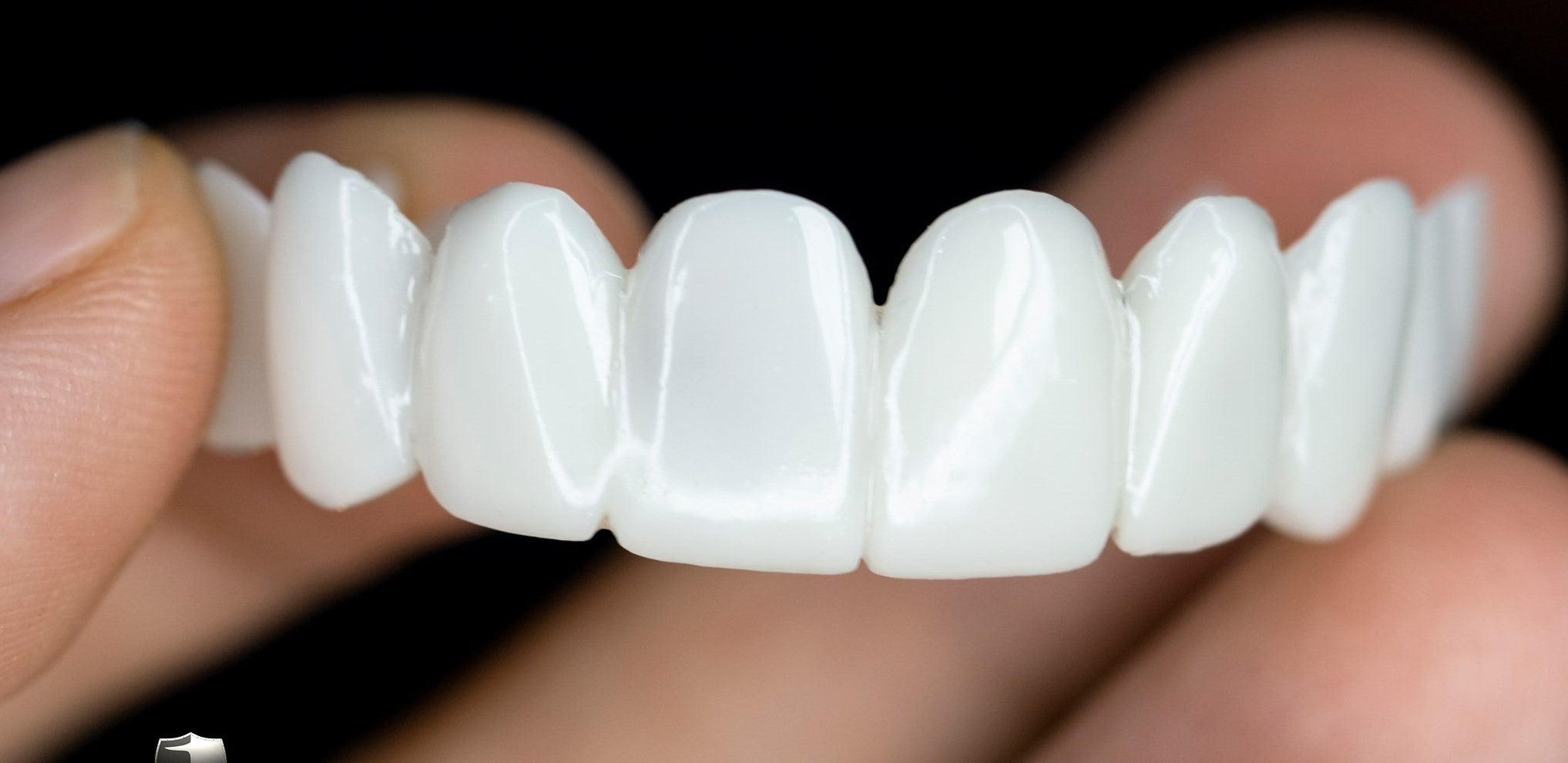 AuraSmile – Adjustable Clear Whitening Braces