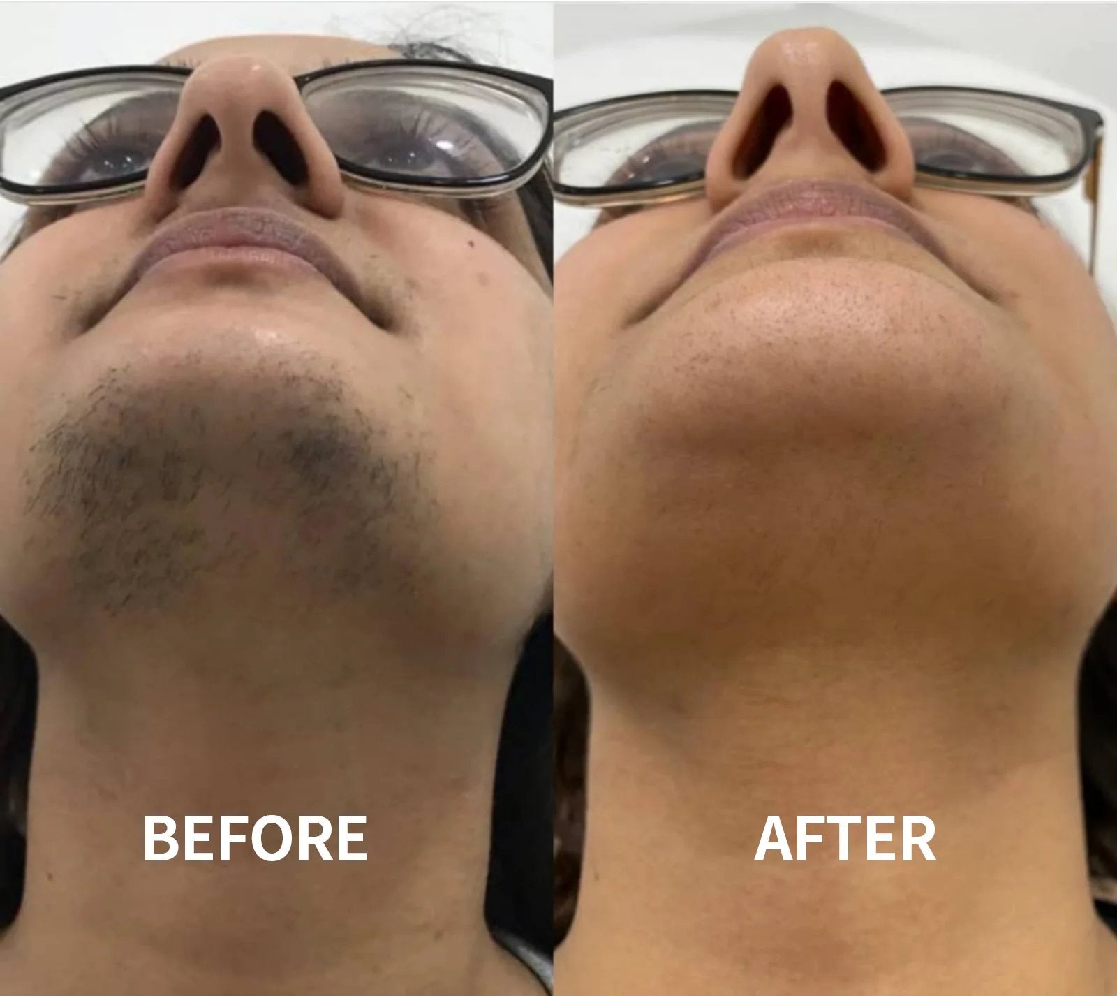 SoftSilk Pro - Painless Facial Hair Remover – Hydrating & Gentle