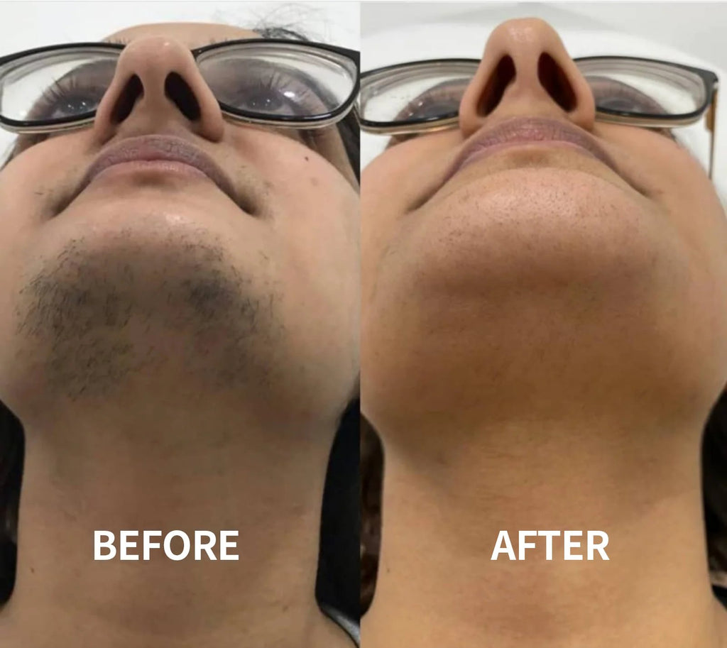 SoftSilk Pro - Painless Facial Hair Remover – Hydrating & Gentle