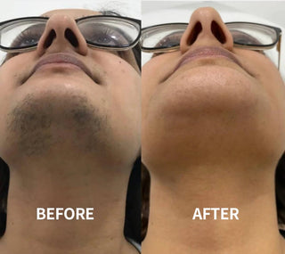 SoftSilk Pro - Painless Facial Hair Remover – Hydrating & Gentle