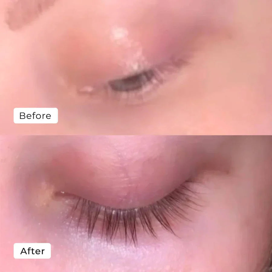 LashGlow – Natural Eyelash Growth Serum
