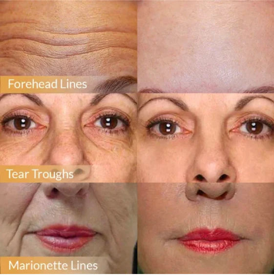 DermaLift – Polypeptide Firming Face Cream