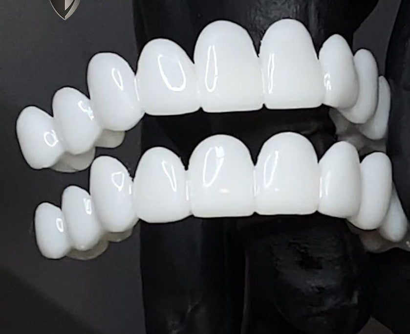 AuraSmile – Adjustable Clear Whitening Braces