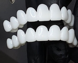 AuraSmile – Adjustable Clear Whitening Braces