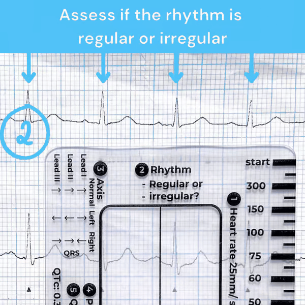 MediTrack – Professional ECG Assessment Pocket Guide