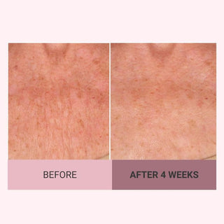 SilkLift – Luxe Body Firming Cream