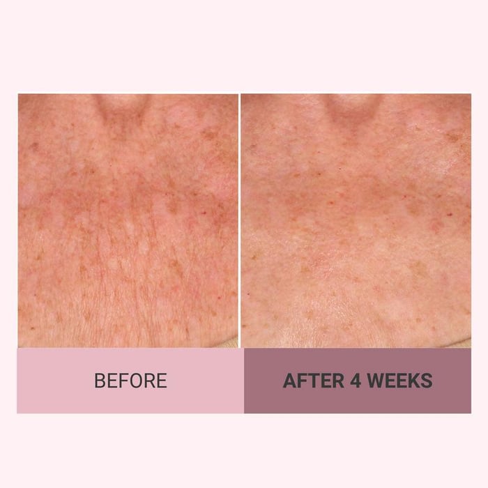 SilkLift – Luxe Body Firming Cream