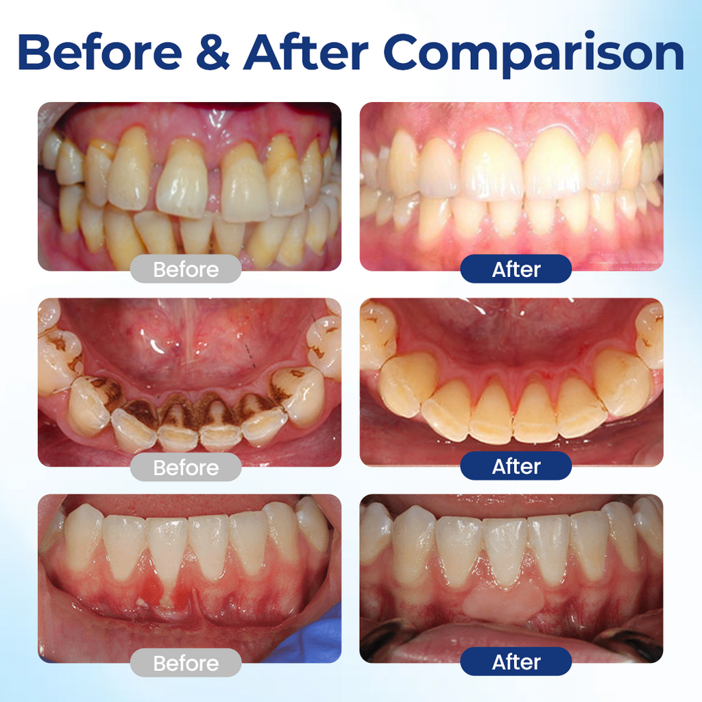 Zensu® BeeTakt Oral Repair Solution.