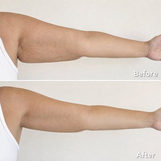 FirmAura – Intensive Body Smoothing & Firming Oil