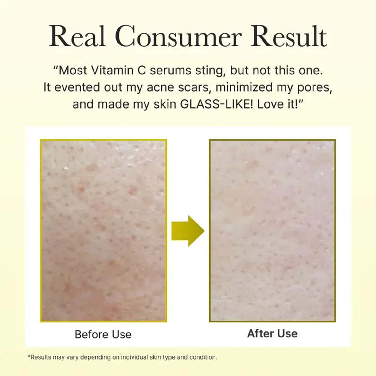 Brightelle – Youthful Skin Repair Serum