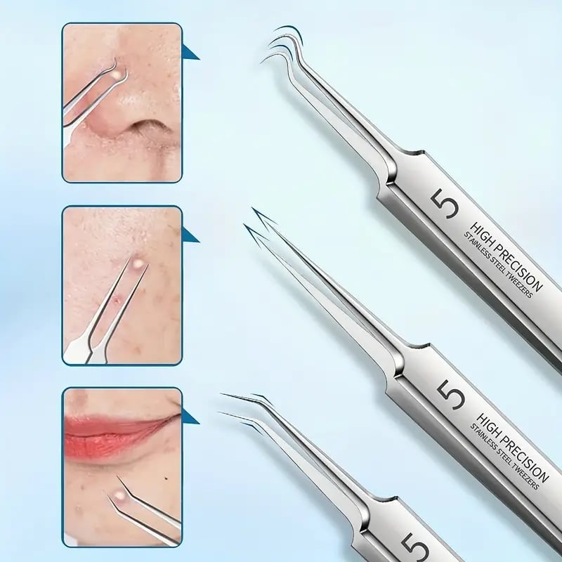 UltraClean - Professional Blackhead Remover Tweezers