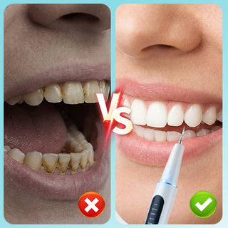 OralCore – Ultrasonic Tooth Cleaner