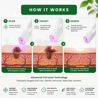 SkinRenew – All-in-One CO₂ Laser Eraser Pen