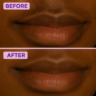 SilkAway – Silky Smooth Facial Hair Removal Cream