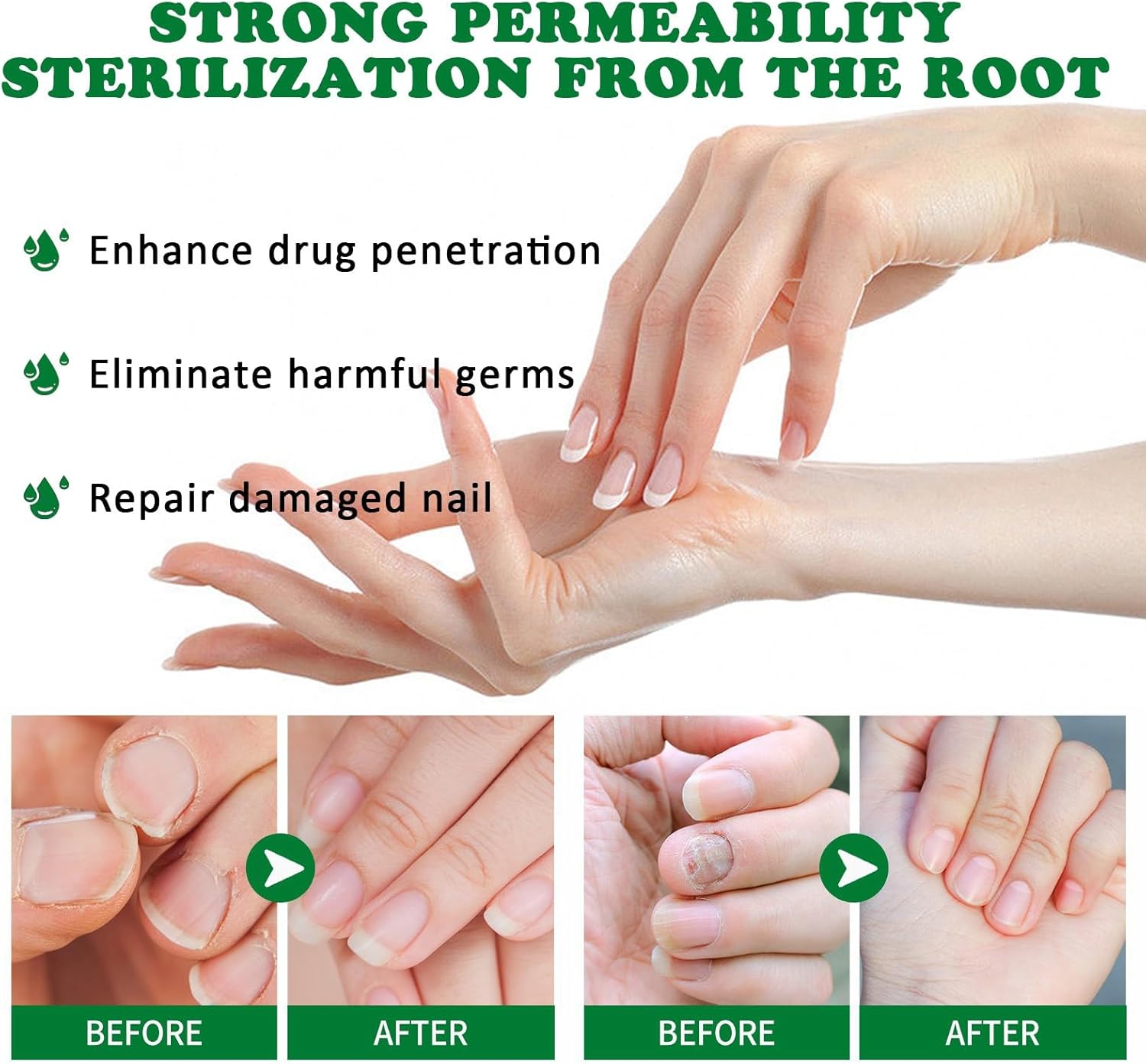RootRenew – Ginger Nail Strengthening Oil