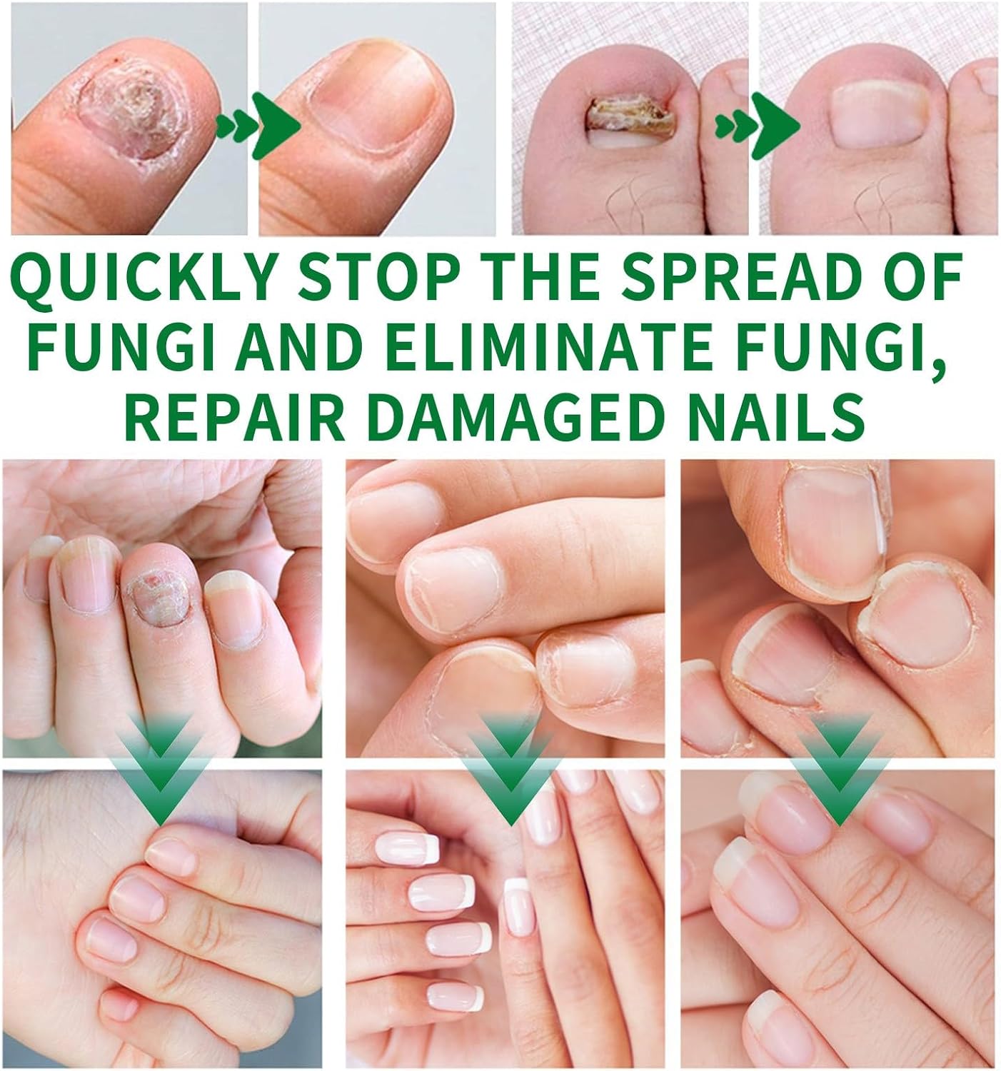 RootRenew – Ginger Nail Strengthening Oil