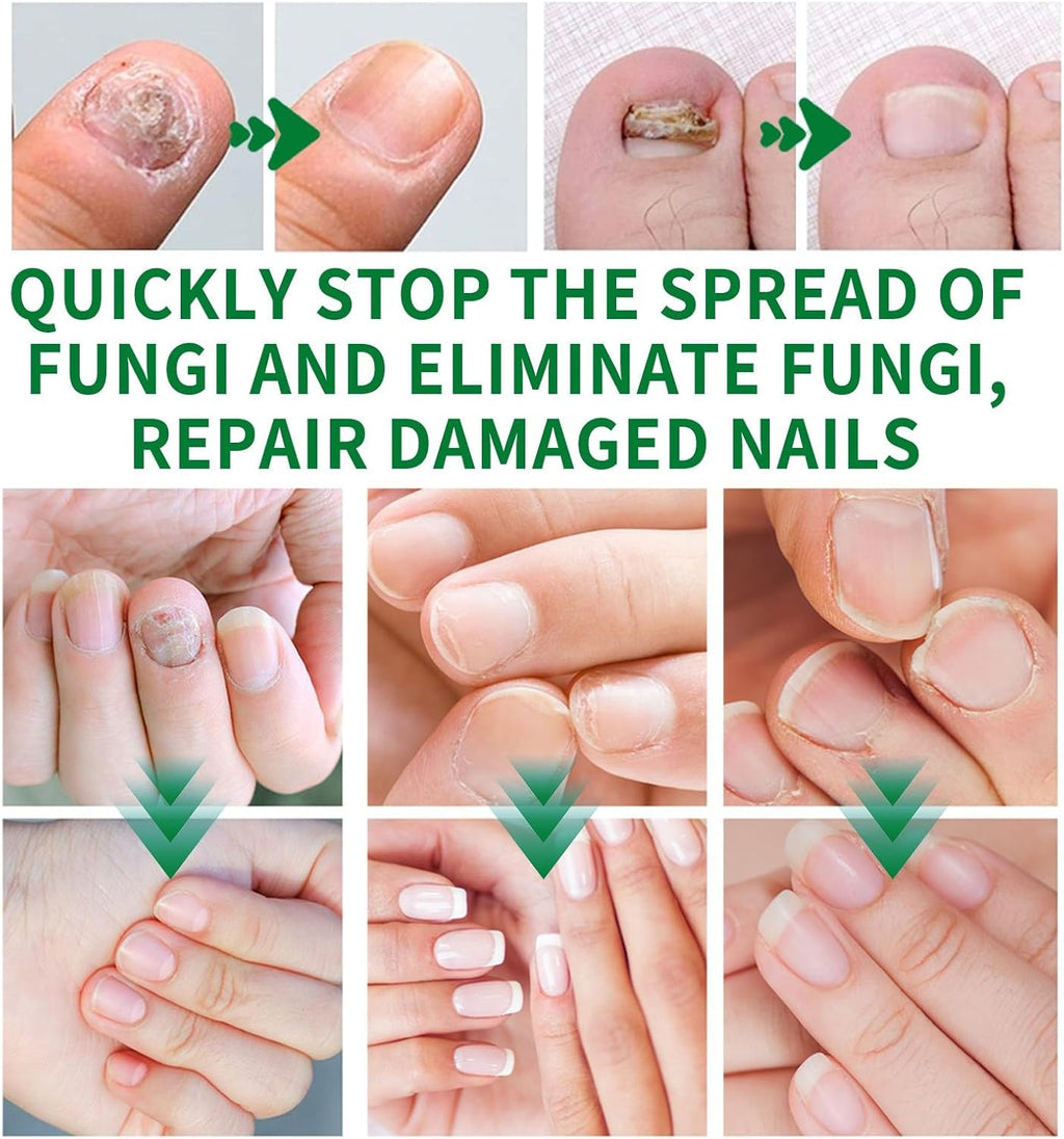 RootRenew – Ginger Nail Strengthening Oil
