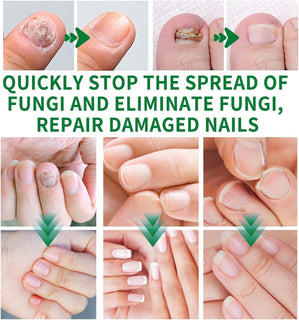 RootRenew – Ginger Nail Strengthening Oil